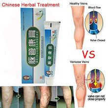 Load image into Gallery viewer, Colorcasa MAIGUAN KANGGAO - Varicose Veins Vasculitis Treatment Legs Care Cream (20g) (2pcs)
